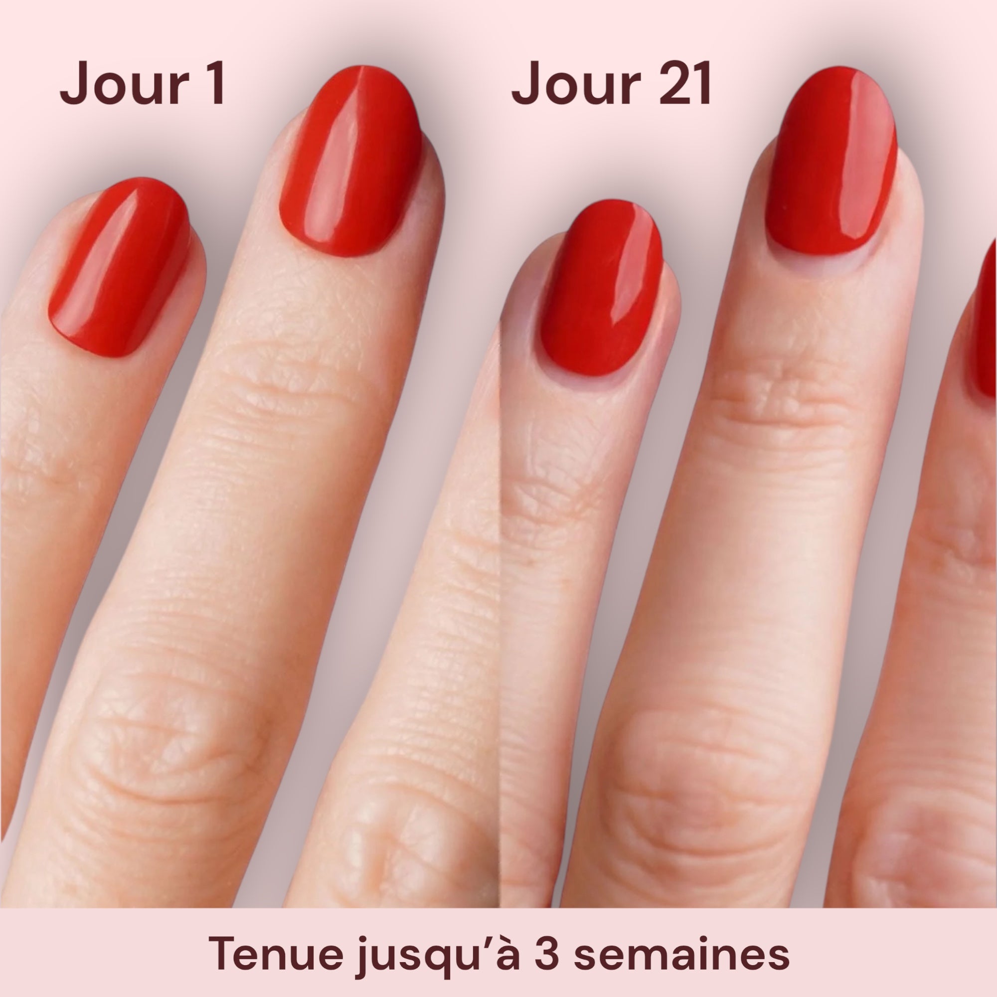 Kit de 5 Curanails